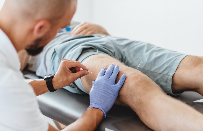 Dry Needling behandelt myofasziale Triggerpunkte in Muskeln durch gezieltes Einstechen einer dünnen Nadel, um muskuläre Dysfunktionen zu lösen und Schmerzen zu reduzieren. Es wird ohne Medikamente oder Flüssigkeiten durchgeführt, daher der Name "trockenes" Needling.