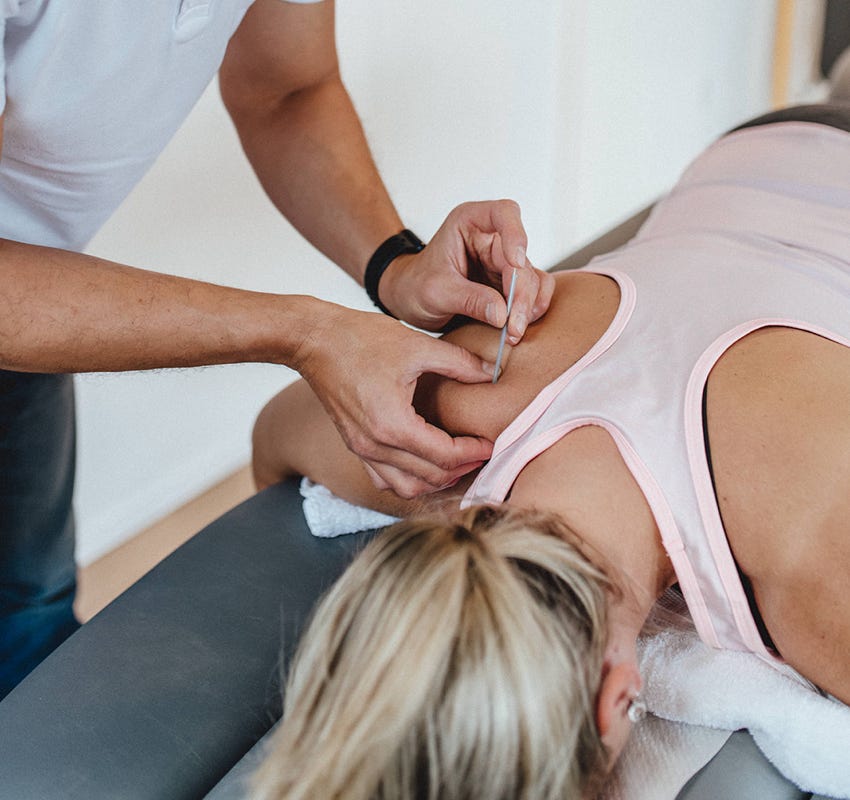 Dry Needling behandelt myofasziale Triggerpunkte in Muskeln durch gezieltes Einstechen einer dünnen Nadel, um muskuläre Dysfunktionen zu lösen und Schmerzen zu reduzieren. Es wird ohne Medikamente oder Flüssigkeiten durchgeführt, daher der Name "trockenes" Needling.