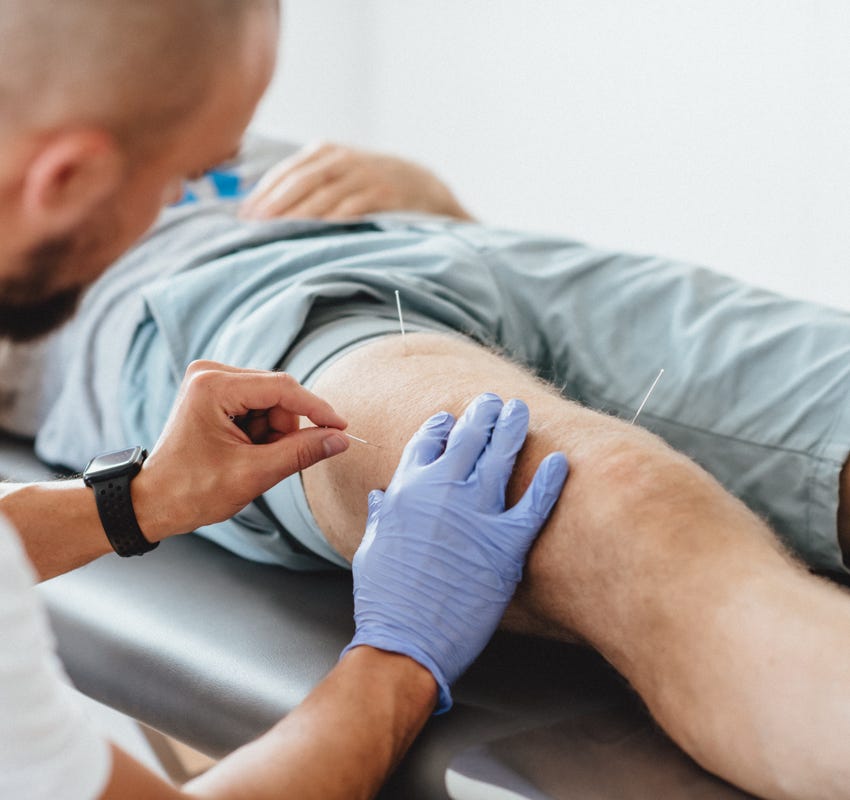 Dry Needling behandelt myofasziale Triggerpunkte in Muskeln durch gezieltes Einstechen einer dünnen Nadel, um muskuläre Dysfunktionen zu lösen und Schmerzen zu reduzieren. Es wird ohne Medikamente oder Flüssigkeiten durchgeführt, daher der Name "trockenes" Needling.