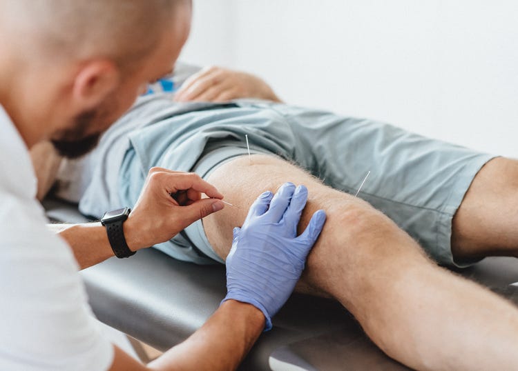 Die Dry Needling-Behandlung kann bei Schmerzen im Bereich der Oberschenkel und Knie  wirksam sein, indem sie gezielt auf Triggerpunkte und Muskelverspannungen eingeht.