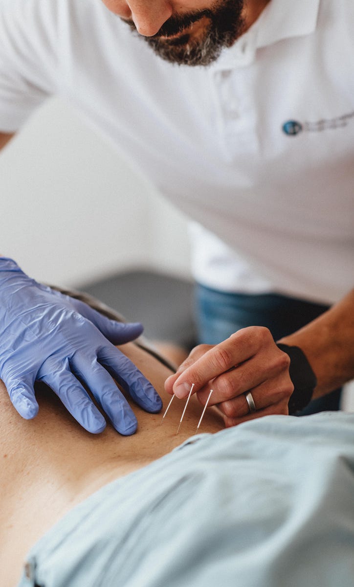 Dry Needling behandelt myofasziale Triggerpunkte in Muskeln durch gezieltes Einstechen einer dünnen Nadel, um muskuläre Dysfunktionen zu lösen und Schmerzen zu reduzieren. Es wird ohne Medikamente oder Flüssigkeiten durchgeführt, daher der Name "trockenes" Needling.