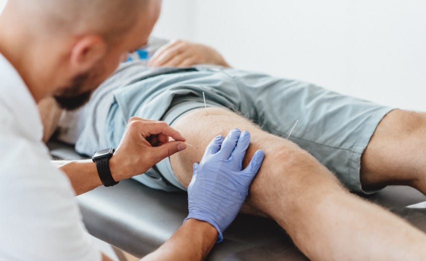 Dry Needling behandelt myofasziale Triggerpunkte in Muskeln durch gezieltes Einstechen einer dünnen Nadel, um muskuläre Dysfunktionen zu lösen und Schmerzen zu reduzieren. Es wird ohne Medikamente oder Flüssigkeiten durchgeführt, daher der Name "trockenes" Needling.